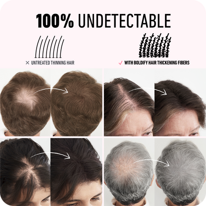 Sevich Hair Building Fiber