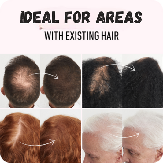 Sevich Hair Building Fiber